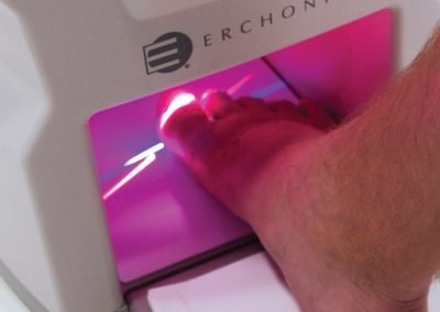 Traitement des ONYCHOMYCOSES tuer le champignon des ongles