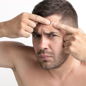 Traitement de l'ACNÉ au LASER en seulement 2 semaines